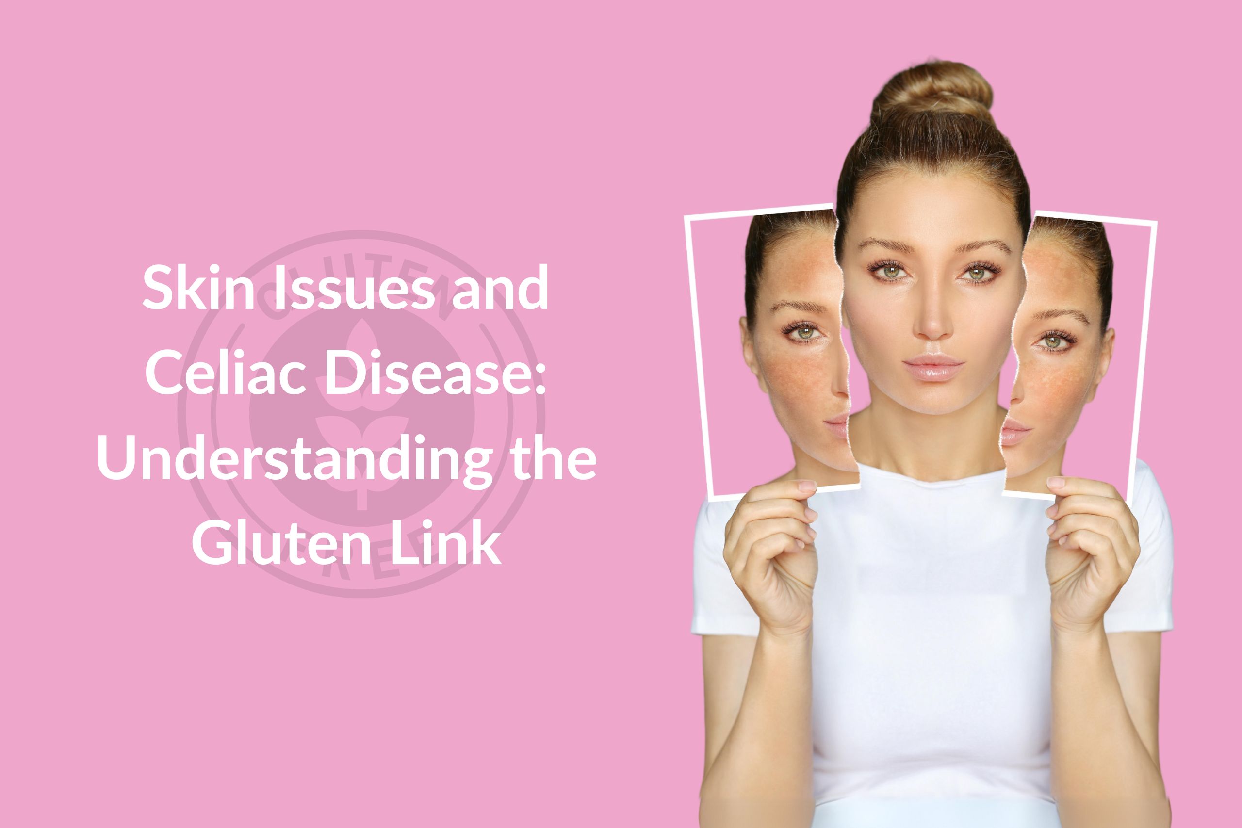 Skin Problem and Celiac Disease connection